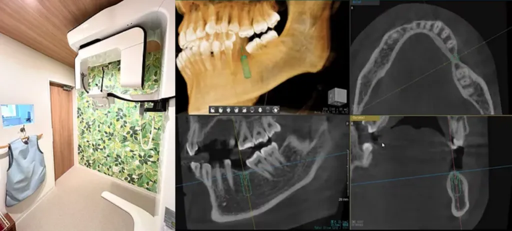 CT・パノラマレントゲン
